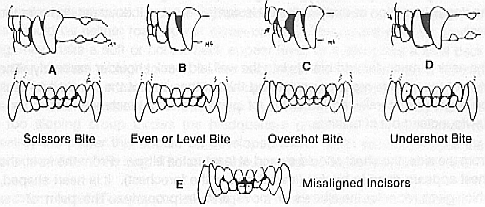 illustration of bites
